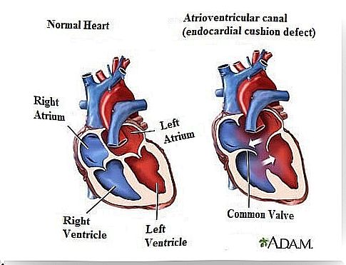 7 facts about heart murmurs