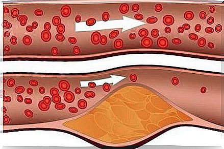 honey and cinnamon to control cholesterol