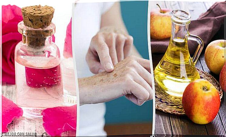 8 natural ways to lighten sun spots on hands