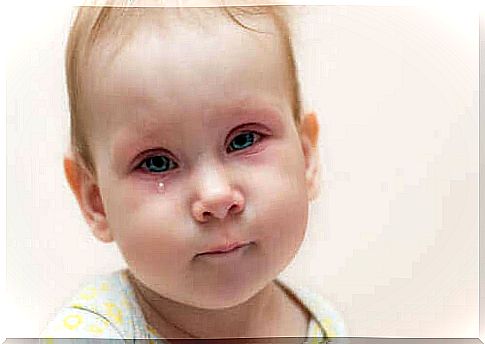 Child conjunctivitis: how to act?