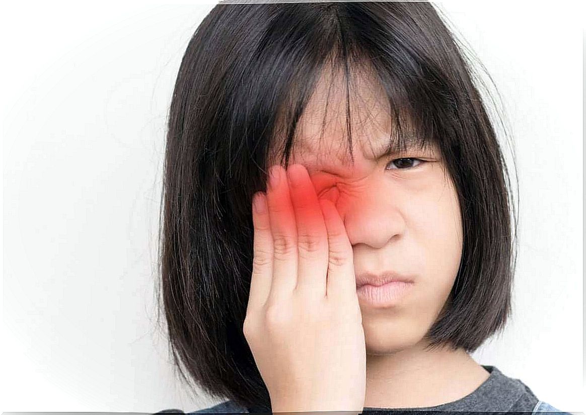 Inflammation of the conjunctiva in a child causes discomfort.