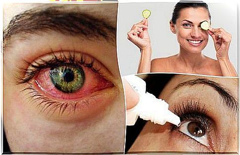 Dry eye: natural remedies