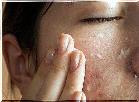 aspirin can be used to treat acne