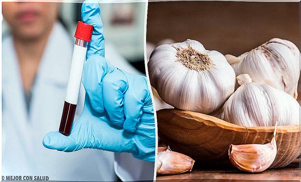 The anticoagulant and health-promoting properties of garlic