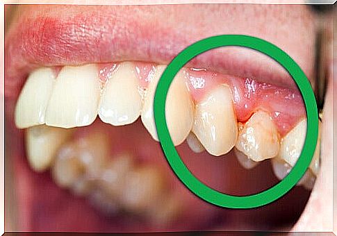 Gums and teeth in good condition with natural products