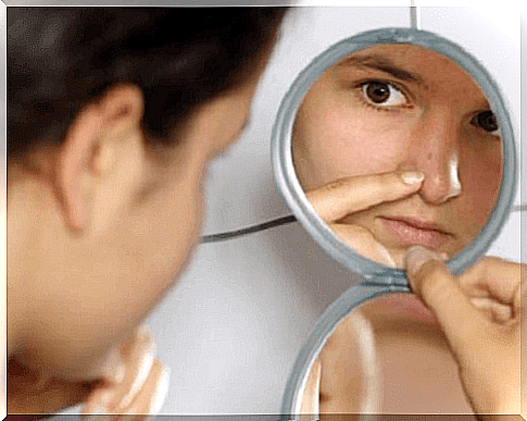 treatment of acne with hydrogen peroxide