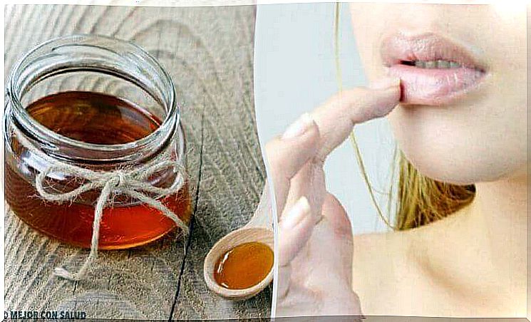 Natural treatments for cracked lips