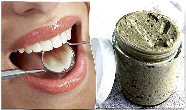 Natural ways to prevent tooth decay