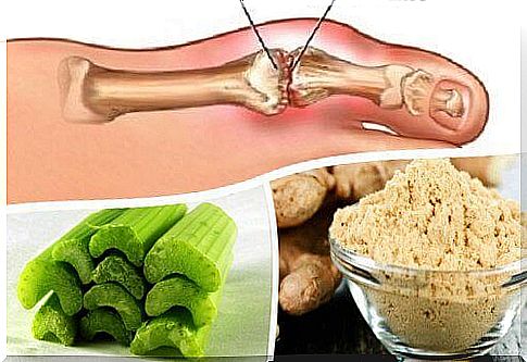 Remove the uric acid crystals with celery and ginger