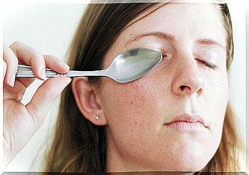 spoon treatment for eyelids