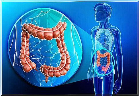 inflammation of the colon