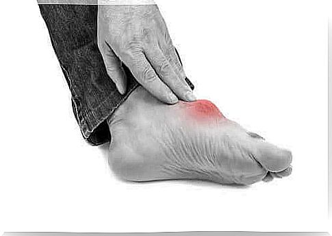 When purines accumulate in the body, a person may develop gout.